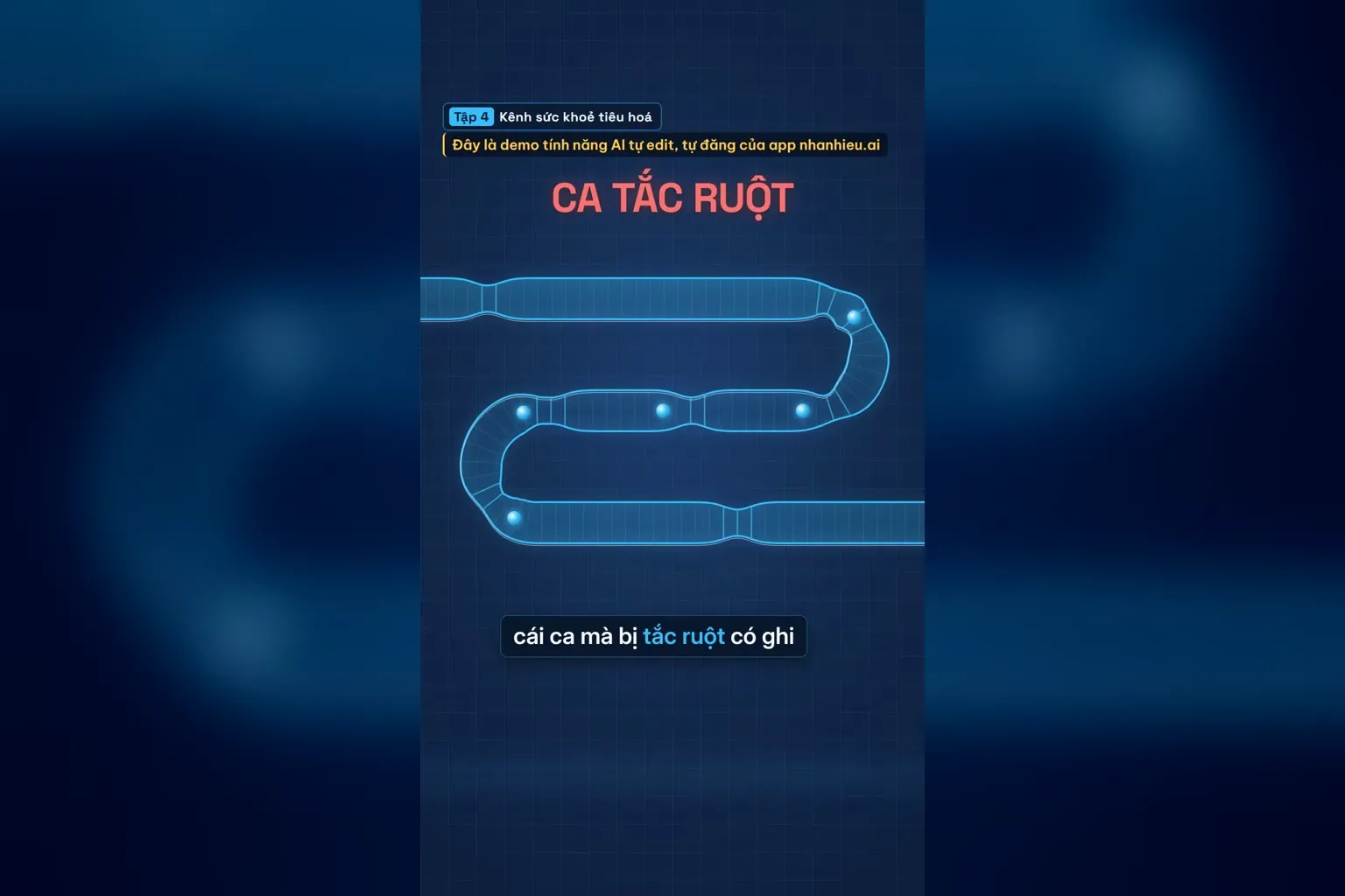 Ca tắc ruột do nuốt kẹo cao su có ghi nhận