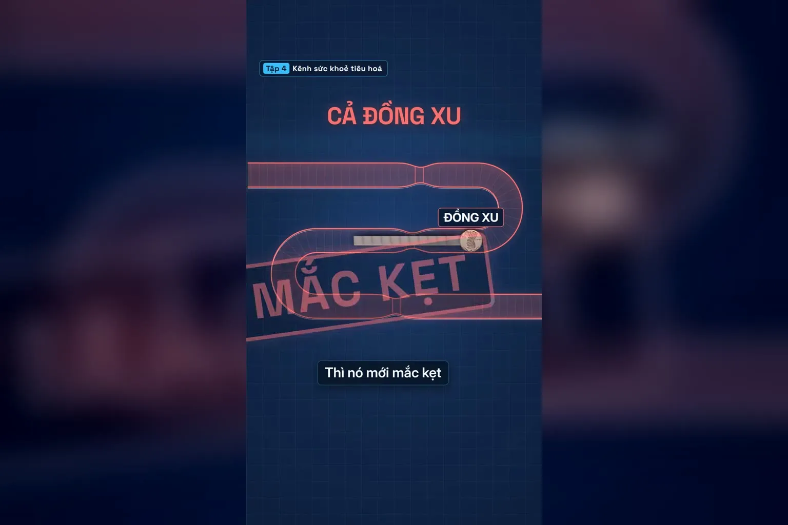 Nuốt kèm đồng xu nên kẹo cao su mắc kẹt